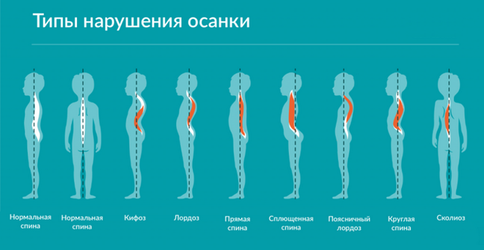 Неврологическое развитие ребенка первого года жизни. Осмотр 